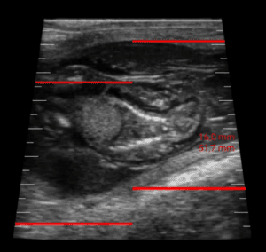 Isabel Salillas on the World Veterinary day reproductive control ultrasound
